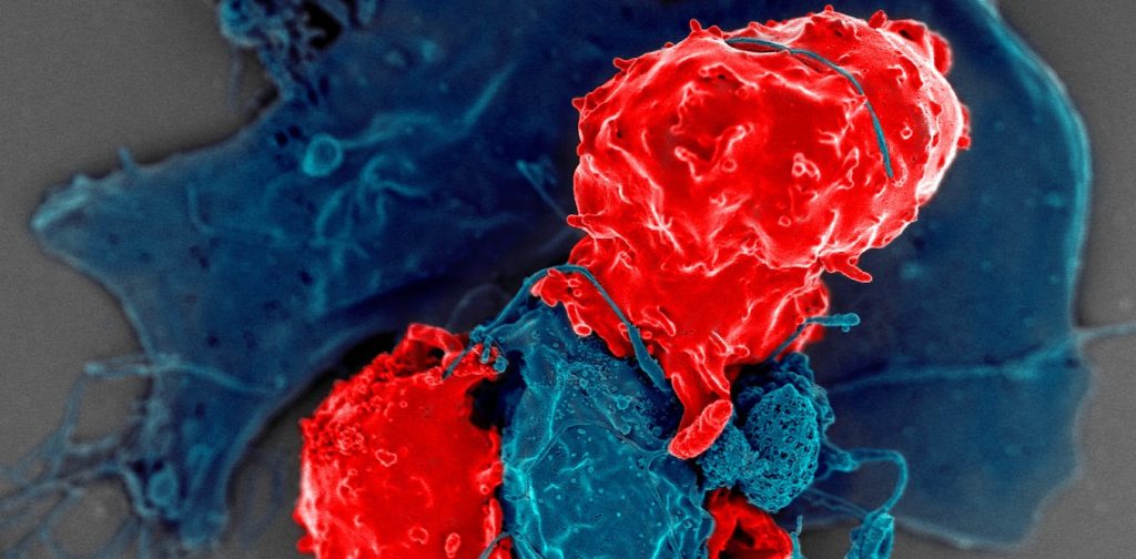 How does your immune system stay balanced? A Nobel Prize-winning answer